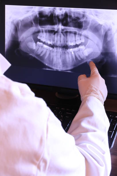 Best Root Canal Emergency Dentist  in Platte City, MO